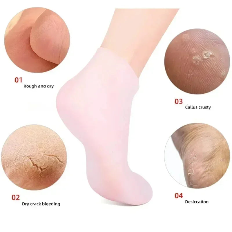 1 par de calcetines hidratantes de silicona, calcetines de gel exfoliante para el talón,  piel muerta agrietada, protector para aliviar el dolor y el cuidado de los pies