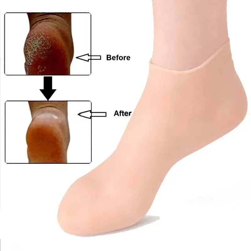 1 par de calcetines hidratantes de silicona, calcetines de gel exfoliante para el talón,  piel muerta agrietada, protector para aliviar el dolor y el cuidado de los pies